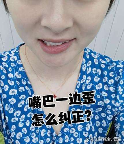 微侧脸拍照嘴歪是正常的吗_脸歪嘴斜拍照怎么办？