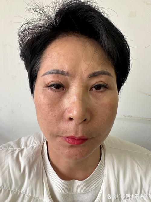 照片美颜太严重怎么p_软件还原图像自然
