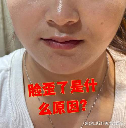 面相学拍照有点嘴歪怎么回事_脸不对称很正常？习惯和拍照影响大！
