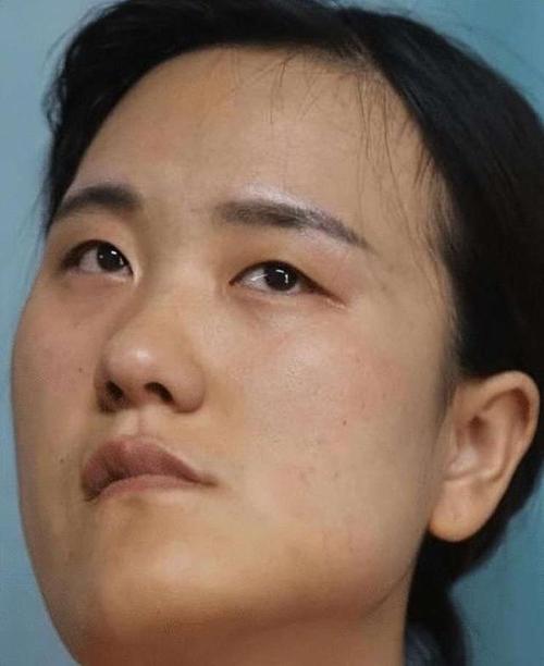 微侧脸拍照嘴歪是正常的吗_脸歪嘴斜拍照怎么办？