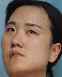 微侧脸拍照嘴歪是正常的吗_脸歪嘴斜拍照怎么办？
