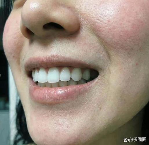 30岁一般女生没有美颜照片_30+女性独特成熟美，宋茜刘涛等真实自然，美丽不止一种标准