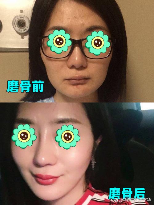 怎么修图下巴变宽_下巴宽度调整,美图秀秀甜盐相机助你自然变美 怎么修图下巴变宽_下巴宽度调整,美图秀秀甜盐相机助你自然变美