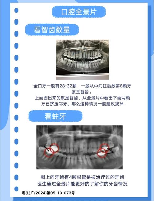 口腔照相参数_口腔摄影调参数，准确记录口腔细节