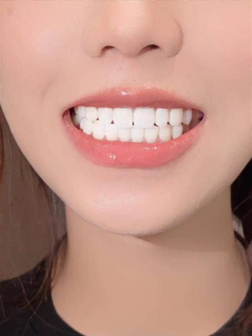 能美白牙齿的修图软件_牙齿美白工具多又好,快速变美选美图秀秀 能美白牙齿的修图软件_牙齿美白工具多又好,快速变美选美图秀秀