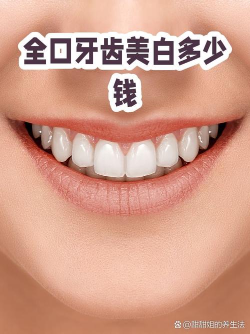 牙齿美白全口图片_并非越白越好,选对方式笑出自然自信 牙齿美白全口图片_并非越白越好,选对方式笑出自然自信