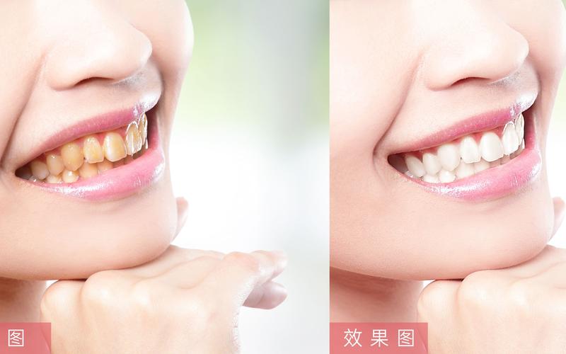 能美白牙齿的修图软件_牙齿美白工具多又好,快速变美选美图秀秀 能美白牙齿的修图软件_牙齿美白工具多又好,快速变美选美图秀秀