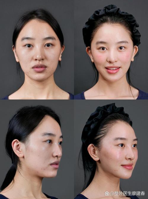 美颜的磨皮和美白哪个好_磨皮美白要适度，别太假