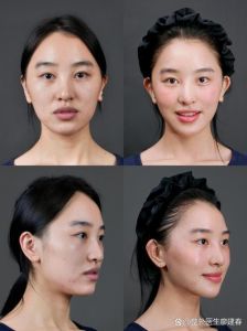 美颜的磨皮和美白哪个好_磨皮美白要适度，别太假