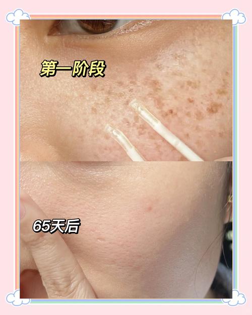 美白淡斑图片_妮维雅630美白防晒，淡斑抗糖，亚洲人必备！