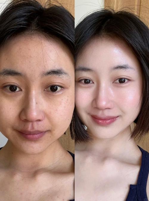 美白身体乳前后对比图_OLAY超白瓶身体乳，清爽美白，告别黄黑皮！