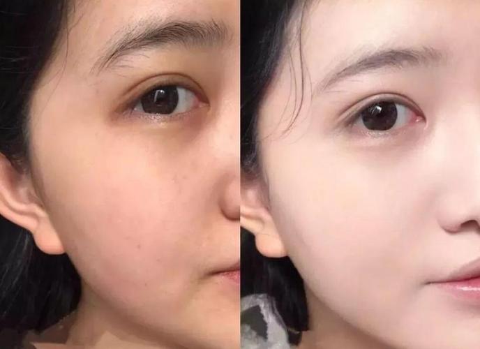 全身美白对比高清图_角质厚难美白?先去角质,选对精华! 全身美白对比高清图_角质厚难美白?先去角质,选对精华!