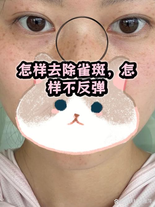 照片怎么给局部美白_局部调亮巧工具，照片更亮自然美