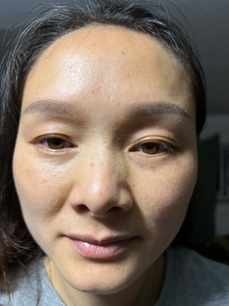 皮肤美白图片_美白肤色管理，理性防晒健康美