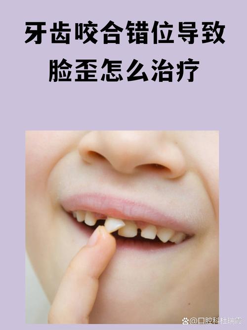 为啥拍照嘴巴歪的怎么补救_嘴巴歪斜拍照怎么办？