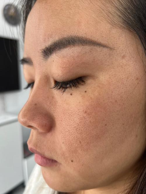 美白淡斑图片_妮维雅630美白防晒，淡斑抗糖，亚洲人必备！