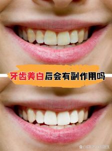 牙齿美白后的照片_小杨牙齿发黄专业美白自信笑容
