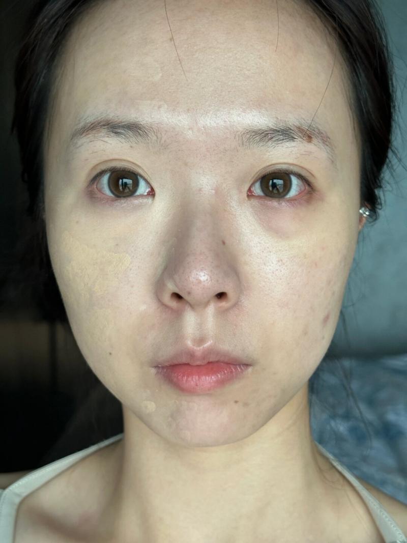 修改人物面部瑕疵原图_快速去除痘痘，AI自动修复