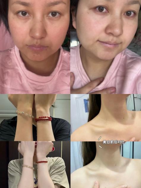 全身美白对比高清图_角质厚难美白?先去角质,选对精华! 全身美白对比高清图_角质厚难美白?先去角质,选对精华!