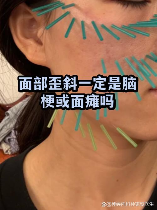 为什么照镜子正常拍照脸是歪的_照片脸歪？角度与不对称惹的祸！