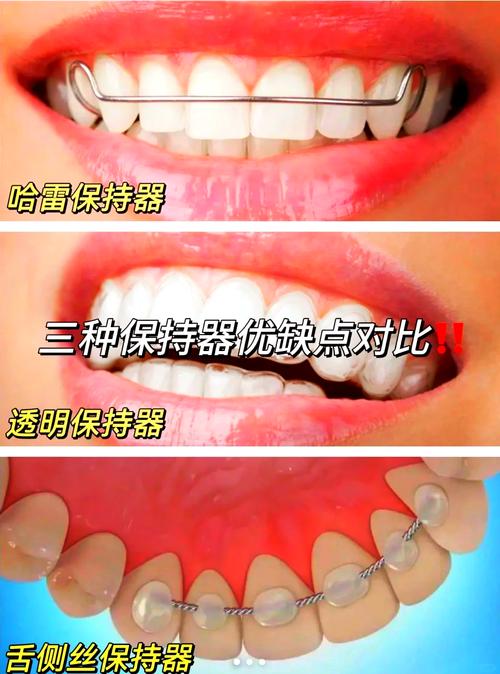 保持器图片高清大图_选哪个？
