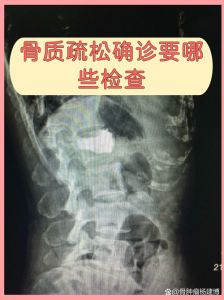 x线拍摄部位参数表_找准位置选对电压距离，用滤线器减散光