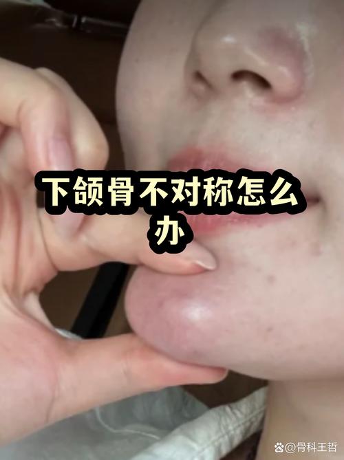 为啥脸拍照是不对称的_拍照脸不对称？多是姿势问题！